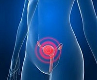 Efectele îndepărtării uterului și colului uterin