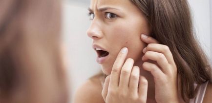 Pattanások az arcon a nők - az első 7 okai előfordulásuk