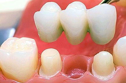 Proteza dentară în stomatologie, stomatologie a centrului medical 