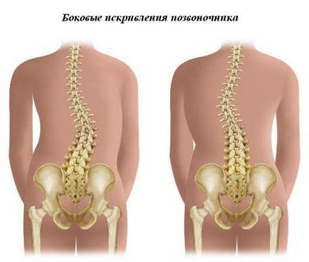 Verificarea coloanei vertebrale