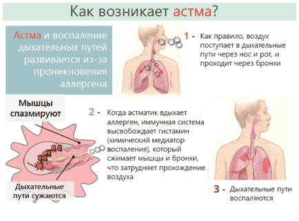 Психосоматика кашель на нервовому грунті у дорослих і дітей, сухий, причини, чи може