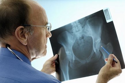 Tratamentul modern al osteoartritei deformante