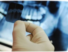 Томографія зубів опис і переваги, схема проведення