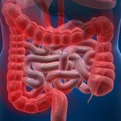 Tuberculoza abdominala si intestinala