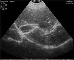 Diagnosticarea cu ultrasunete a ceea ce este