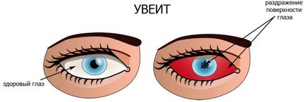 У дитини червоні очі причини та методи усунення проблеми