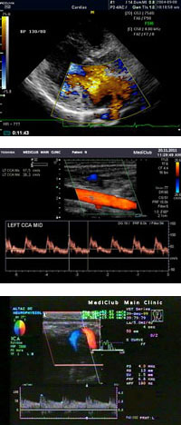 Sistemul cardiovascular