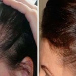 Вітаміни Алерана для росту волосся відгуки трихолог, інструкція ціна склад
