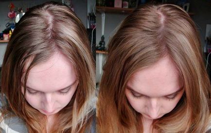 Вітаміни Алерана для росту волосся відгуки трихолог, інструкція ціна склад