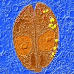 Etiologie ascariasis, epidemiologie