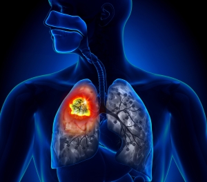Boli ale sistemului respirator la bărbați și femei în vârstă înaintată