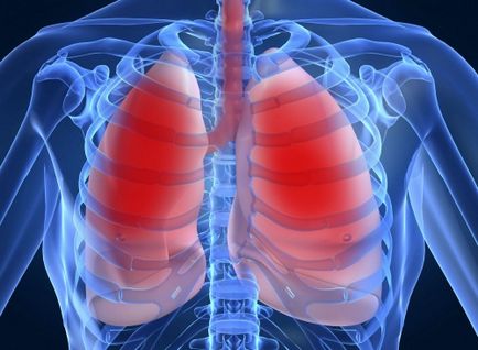 Ce este mai bine este mrt sau kt pulmonar, rezonanță magnetică sau tomografie computerizată a plămânilor