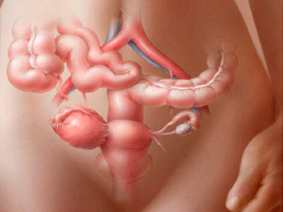 Tipuri de ovarez cystadenocarcinom, simptome, cauze și tratament