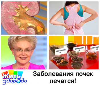 Elena Malysheva vesebetegség és húgyúti fertőzések gyógyítható! Ne késlekedjen kezelés!