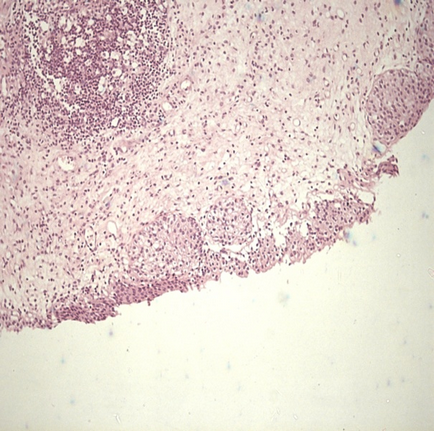 Clinica de cistita - urologie foliculară mgmsu