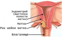 Гайморит - симптоми, причини, ускладнення