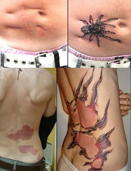 Camouflage tatuaj - de pe cicatrici!