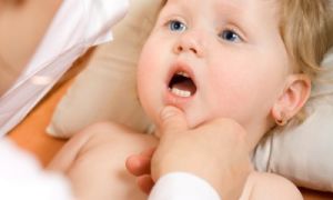 Кандидоз у новонароджених причини виникнення та методи лікування