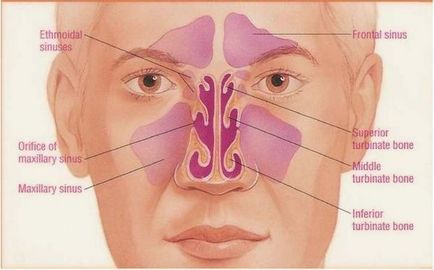 Sinuzită catarală - simptome și tratamentul sinuzitei edematoase la Moscova