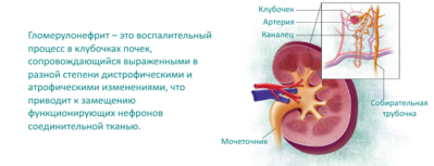 Clasificarea glomerulonefritei