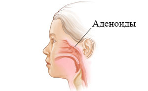 Коли перестають рости аденоїди