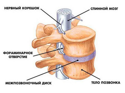 Лікування грижі хребта без операції консервативна і народна медицина