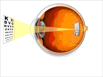 Лікування макулодистрофії сітківки ока