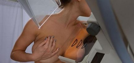 Мамографія молочних залоз розшифровка, яка норма, результати і висновок