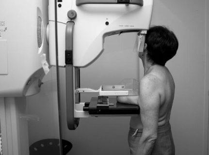 Мамографія молочних залоз результати