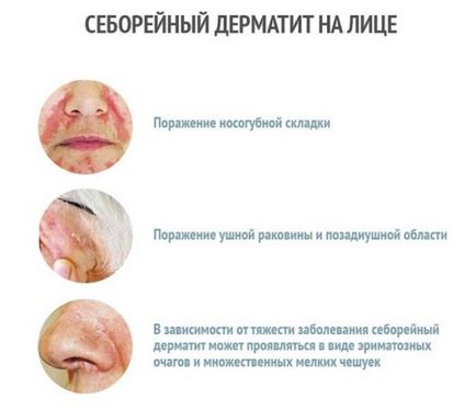 Este posibil să mergeți la un salon de bronzare cu dermatită?