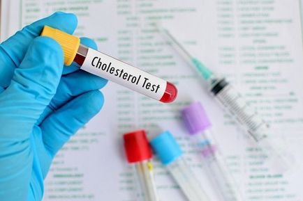 Norma de colesterol uman după 60 de ani