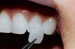 Новини стоматології та члх нові інструменти і препарати для лікування зубів, новинки в
