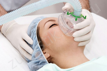 Anestezie generală în stomatologie, indicații, contraindicații