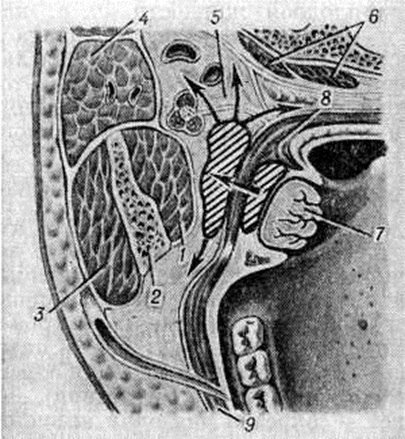 Abcesul abdominal