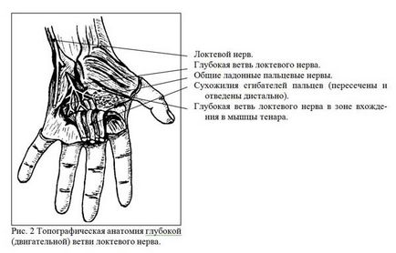 Chirurgie pe nervii mâinii, traumatologie pentru toți