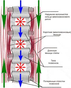 Остеохондроз, симптоми остеохондрозу, профілактика остеохондрозу