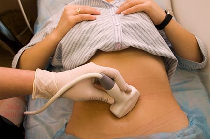 Leválása a petesejt a korai terhesség - tünetei és okai