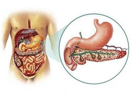 Pancreatita în diabet zaharat tot ce trebuie să știți, pancreatită