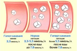 Панкреатогенний цукровий діабет вимоги дієти