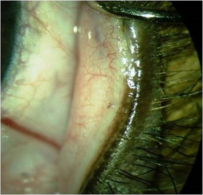 Patologii de creștere a genelor - dysthiasis, trichiasis și ectopic genital la câini, clinică veterinară