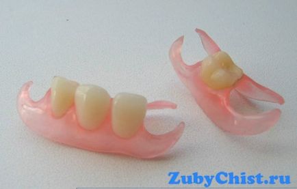 Dinții din față aleg cele mai bune coroane ceramice și protezele temporare