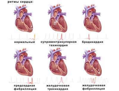 Передозування новопассіта симптоми і наслідки