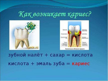 Чому болять зуби 4 клас