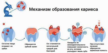 Чому руйнуються зуби у чоловіків і жінок