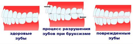 Чому руйнуються зуби у чоловіків і жінок