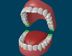 Clătire dinte cu sifon, dinți sănătoși