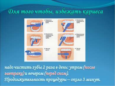 Представяне - защо зъбобол Клас 4 - свободно изтегляне