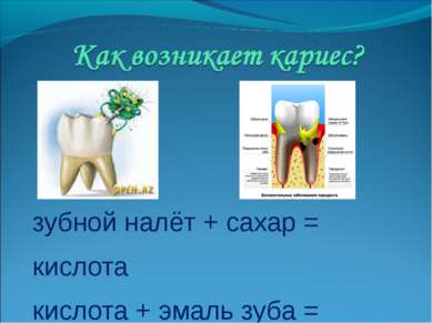 Презентація - чому болять зуби 4 клас - завантажити безкоштовно