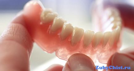 Протезування зубів знімні або незнімні - які вибрати