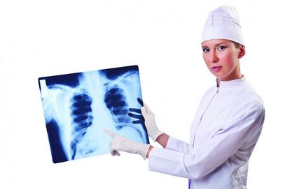 Cancerul pulmonar la o vârstă fragedă la femei tinere cu fumat